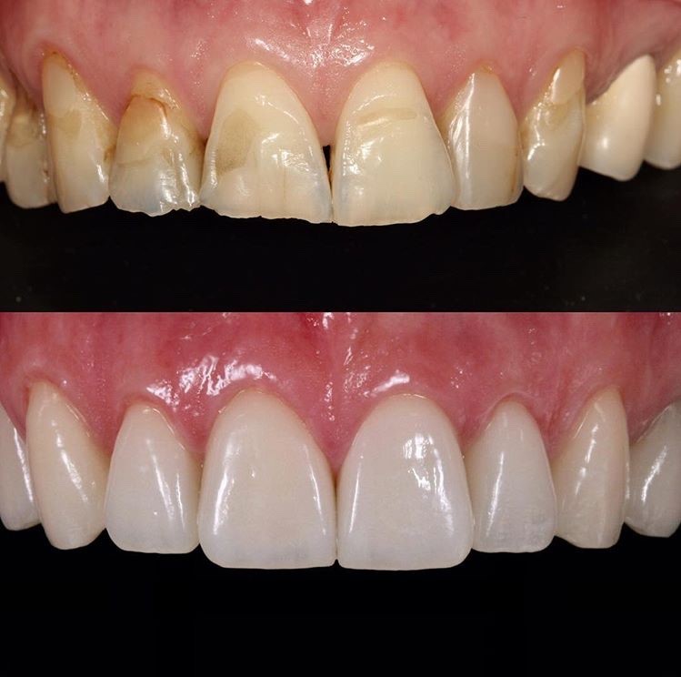 fatete-dentare-arad
